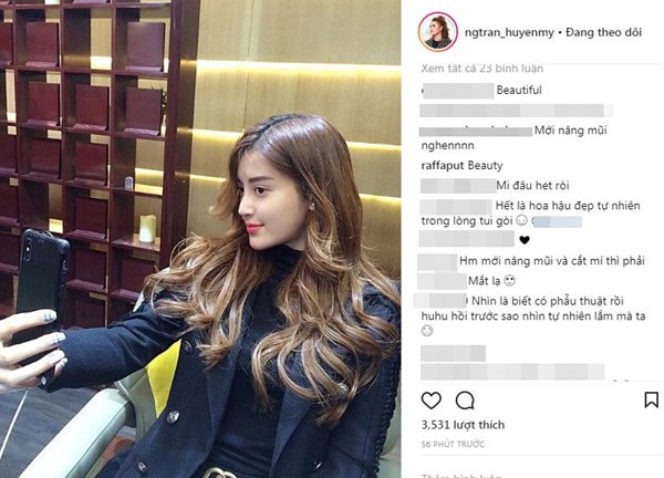 Á hậu Huyền My bị nghi thẩm mỹ vì gương mặt bất ngờ khác lạ - Hình 1