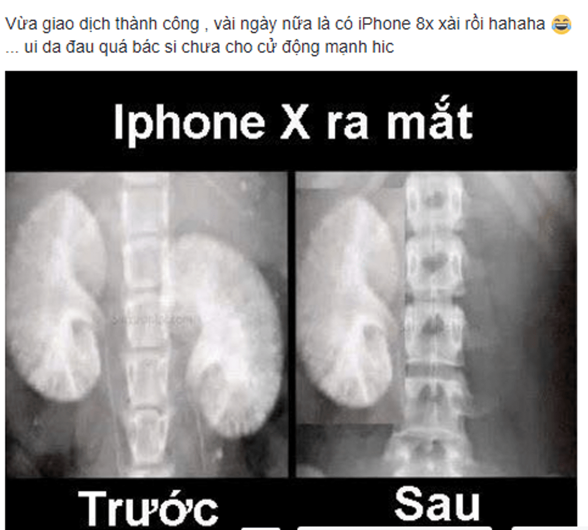 Cộng đồng mạng - Bi hài quanh chuyện sở hữu iPhone 8 của người dùng Việt (Hình 12).