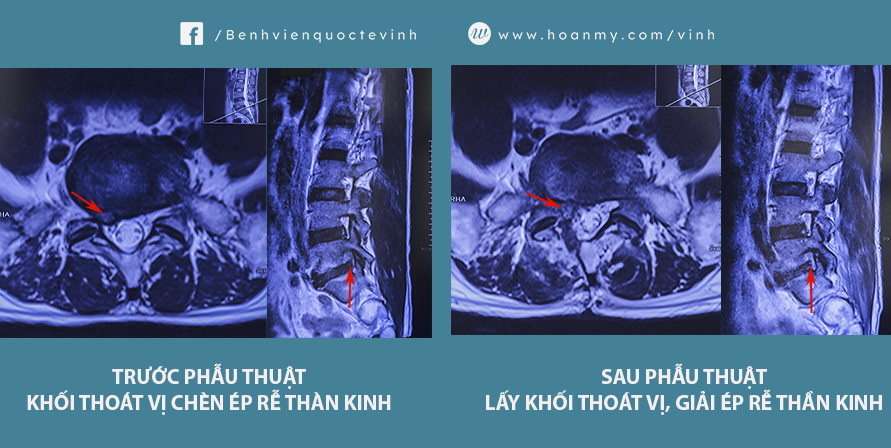 hinh anh phau thuat 2