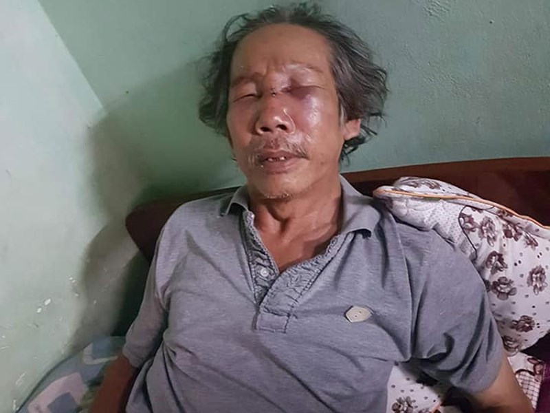 Nóng 24h: Bắt "nữ quái" vận chuyển trái phép ma túy - Hình 5