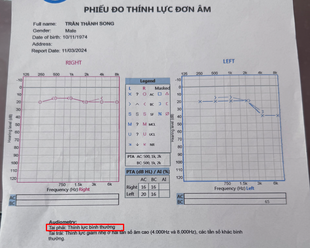 Sức khỏe - Nhờ có Kim Thính anh Song đã cải thiện thính lực, không còn ù tai, nghe kém (Hình 4).