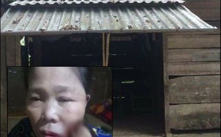 Bệnh lạ đục khoét khuôn mặt, người phụ nữ đau đớn trở thành “quái nhân” Bệnh lạ đục khoét khuôn mặt, người phụ nữ đau đớn trở thành “quái nhân”