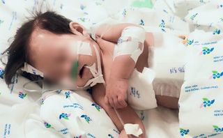 Nhiễm hai siêu vi khuẩn kháng thuốc, phổi bé gái chứa đầy dịch mủ Nhiễm hai siêu vi khuẩn kháng thuốc, phổi bé gái chứa đầy dịch mủ