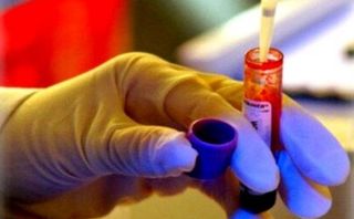 Những dấu hiệu cảnh báo có thể bạn đã nhiễm HIV Những dấu hiệu cảnh báo có thể bạn đã nhiễm HIV