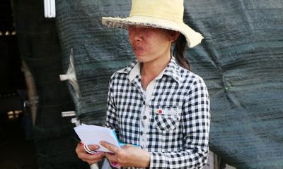 Ninh Thuận: Cảnh báo tình trạng ngứa, mẫn đỏ coi chừng nhiễm giun đũa chó
