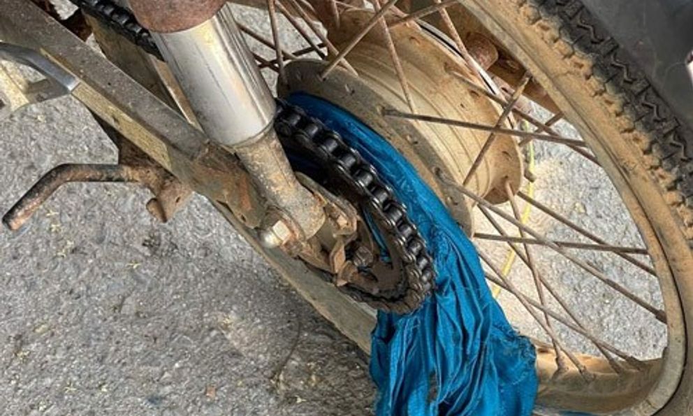 Bé gái ngã gãy tay do áo khoác chống nắng bị cuốn vào bánh xe