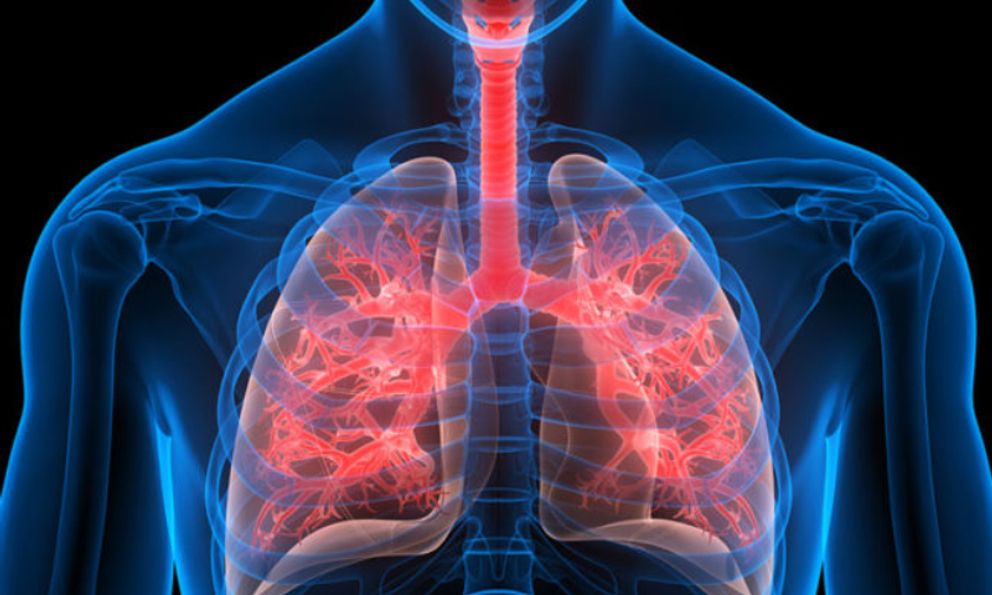 Phần mềm AI phát hiện bệnh phổi chỉ trong vài phút